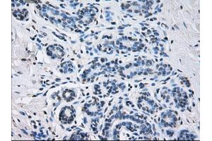 Immunohistochemical staining of paraffin-embedded breast tissue using anti-SORD mouse monoclonal antibody. (SORD 抗体)