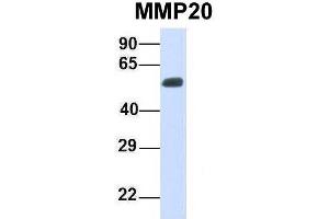 Host:  Rabbit  Target Name:  MMP20  Sample Type:  Human Fetal Muscle  Antibody Dilution:  1. (MMP20 抗体  (Middle Region))