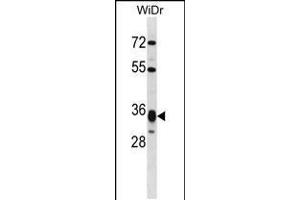 Western blot analysis in WiDr cell line lysates (35ug/lane). (HMGCL 抗体  (AA 161-190))