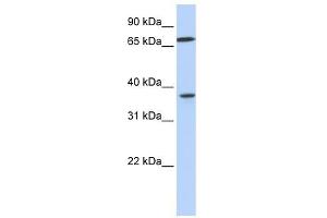 MAP2K3 antibody used at 1 ug/ml to detect target protein. (MAP2K3 抗体  (C-Term))