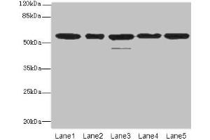 Western blot All lanes: RBBP4 antibody at 1 μg/mL Lane 1: Hela whole cell lysate Lane 2: LO2 whole cell lysate Lane 3: K562 whole cell lysate Lane 4: NIH/3T3 whole cell lysate Lane 5: Raji whole cell lysate Secondary Goat polyclonal to rabbit IgG at 1/10000 dilution Predicted band size: 48, 47, 44 kDa Observed band size: 48, 55 kDa (Retinoblastoma Binding Protein 4 抗体  (AA 246-425))