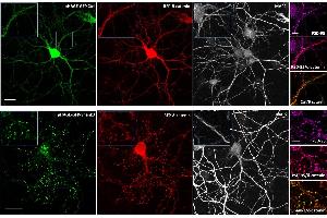 Effect of Shank3 on localization of δ-catenin in neurons. (MAP2 抗体)