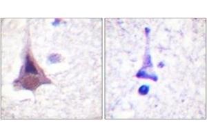 Immunohistochemistry analysis of paraffin-embedded human brain tissue, using MYPT1 (Ab-853) Antibody. (PPP1R12A 抗体  (AA 621-670))