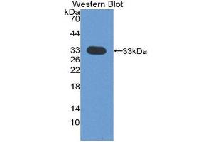 Western Blotting (WB) image for anti-Cyclin-Dependent Kinase 4 (CDK4) (AA 6-295) antibody (ABIN1858347) (CDK4 抗体  (AA 6-295))