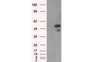 Western Blotting (WB) image for anti-SHC (Src Homology 2 Domain Containing) Transforming Protein 1 (SHC1) antibody (ABIN1499993) (SHC1 抗体)