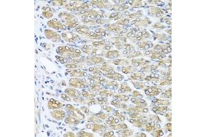 Immunohistochemistry of paraffin-embedded mouse stomach using RAC2 antibody (ABIN5970487) at dilution of 1/100 (40x lens). (RAC2 抗体)