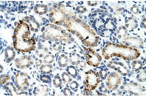 Human Kidney; Rabbit Anti-ZESR2 Antibody. (ZRSR2 抗体  (C-Term))