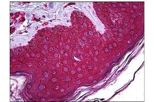Immunohistochemistry (IHC) image for anti-Abhydrolase Domain Containing 5 (ABHD5) antibody (ABIN781986) (ABHD5 抗体)