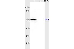 Lane 1: rat brain lysates Lane 2: rat heart lysates probed with Anti MAP3K8/TPL2 Polyclonal Antibody, Unconjugated (ABIN701275) at 1:200 in 4 °C. (MAP3K8 抗体  (AA 121-220))