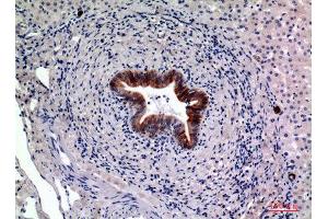 Immunohistochemistry (IHC) analysis of paraffin-embedded Human Liver, antibody was diluted at 1:100. (CD19 抗体  (Internal Region))