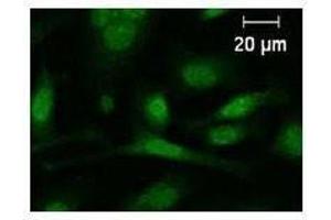 Immunostaining analysis in HeLa cells. (c-FOS 抗体)