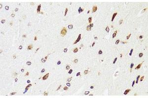 Immunohistochemistry of paraffin-embedded Rat brain using EDF1 Polyclonal Antibody at dilution of 1:100 (40x lens). (EDF1 抗体)