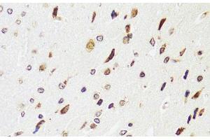 Immunohistochemistry of paraffin-embedded Rat brain using EDF1 Polyclonal Antibody at dilution of 1:100 (40x lens). (EDF1 抗体)