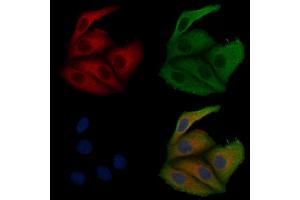 ABIN6257498 and ABIN6275600 staining Hela cells by IF/ICC. (Sorting Nexin 1 抗体  (Internal Region))