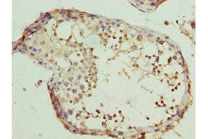 Immunohistochemistry of paraffin-embedded human testis tissue using ABIN7146467 at dilution of 1:100 (Calmegin 抗体  (AA 200-400))