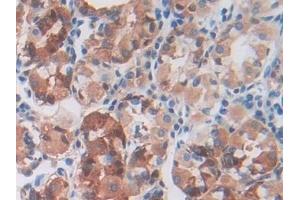 Immunohistochemistry (IHC) image for anti-CUB Domain Containing Protein 1 (CDCP1) (AA 689-836) antibody (ABIN7434047)