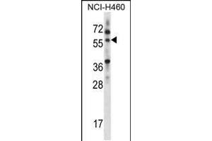 Western blot analysis in NCI-H460 cell line lysates (35ug/lane). (MINPP1 抗体  (C-Term))