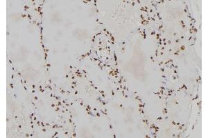 ABIN6273460 at 1/100 staining Human lung tissue by IHC-P. (CENPL 抗体  (Internal Region))