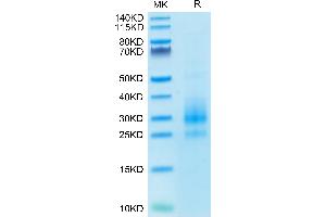 SDS-PAGE (SDS) image for Killer Cell Lectin-Like Receptor Subfamily C, Member 2 (KLRC2) (AA 94-231) protein (His tag) (ABIN7275333)
