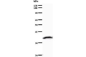 Western Blotting (WB) image for anti-ZINC FINGER PROTEIN 136 (ZNF136) antibody (ABIN932448) (ZNF136 抗体)