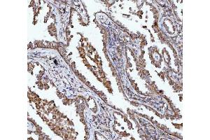 IHC analysis of BBS9 using anti-BBS9 antibody (ABIN7601518). (BBS9 抗体  (AA 37-793))
