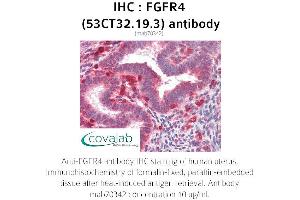 Image no. 2 for anti-Fibroblast Growth Factor Receptor 4 (FGFR4) antibody (ABIN2851987) (FGFR4 抗体)