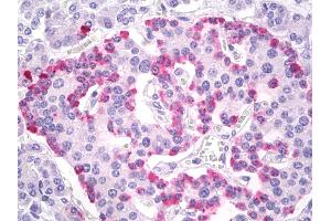 Anti-Glucagon antibody IHC of human pancreas, islets of Langerhans. (Glucagon 抗体  (AA 25-54))