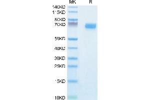 EPH Receptor B2 Protein (EPHB2) (AA 19-543) (His tag)