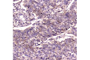 IHC analysis of IGF2R using anti-IGF2R antibody . (IGF2R 抗体  (AA 424-529))