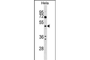 ALG2 Antibody (Center) (ABIN1538197 and ABIN2848872) western blot analysis in Hela cell line lysates (35 μg/lane). (ALG2 抗体  (AA 254-282))