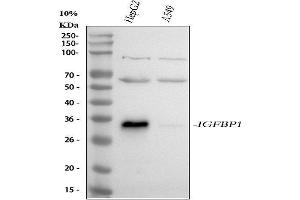 Western blot analysis of IGFBP1 using anti-IGFBP1 antibody (ABIN5518851).