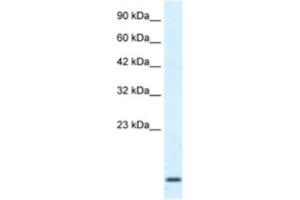 Western Blotting (WB) image for anti-Homeobox A1 (HOXA1) antibody (ABIN2461047) (HOXA1 抗体)