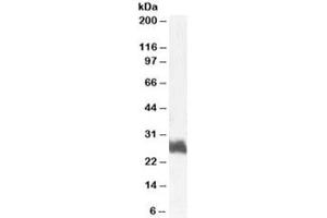 Western blot testing of human bone marrow lysate with FRA1 antibody at 1ug/ml. (FOSL1 抗体)