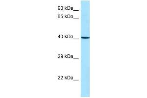 WB Suggested Anti-ARPC1B Antibody Titration: 1. (ARPC1B 抗体  (Middle Region))