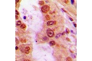 Immunohistochemistry (IHC) image for anti-Nitric Oxide Synthase 2, Inducible (NOS2) (N-Term) antibody (ABIN7302720)