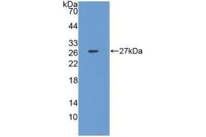 Detection of Recombinant CLU, Porcine using Polyclonal Antibody to Clusterin (CLU) (Clusterin 抗体  (AA 229-446))