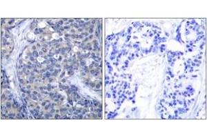 Immunohistochemistry (IHC) image for anti-zeta-Chain (TCR) Associated Protein Kinase 70kDa (ZAP70) (AA 286-335) antibody (ABIN2889082) (ZAP70 抗体  (AA 286-335))