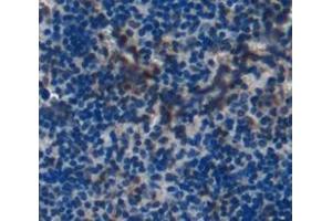 Used in DAB staining on fromalin fixed paraffin- embedded spleen tissue (LTA4H 抗体  (AA 135-272))