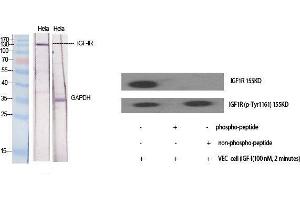 Western Blot (WB) analysis of specific cells using IGF-IR Polyclonal Antibody. (IGF1R 抗体  (Ser1026))