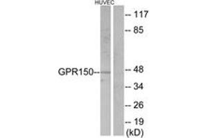 Western blot analysis of extracts from HuvEc cells, using GPR150 Antibody. (GPR150 抗体  (AA 361-410))