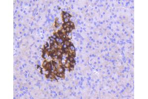 Immunohistochemistry of paraffin-embedded human pancreas using MCL1 antibody (ABIN5997051) at dilution of 1/100 (40x lens). (MCL-1 抗体)