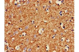 IHC image of ABIN7160401 diluted at 1:400 and staining in paraffin-embedded human brain tissue performed on a Leica BondTM system. (MBP 抗体  (AA 1-197))