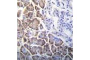 Immunohistochemistry (Paraffin-embedded Sections) (IHC (p)) image for anti-Inhibitor of DNA Binding 1, Dominant Negative Helix-Loop-Helix Protein (ID1) (AA 73-101), (Middle Region) antibody (ABIN952815)