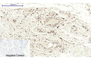 Immunohistochemical analysis of paraffin-embedded human breast tissue. (PTGS2 抗体  (AA 530-610))