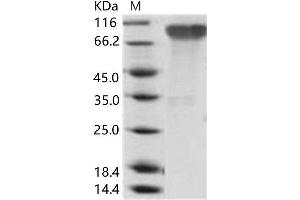 Western Blotting (WB) image for Epstein-Barr Virus Membrane Antigen gp350 (EBV gp350) protein (His tag) (ABIN7198936)