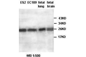 Image no. 2 for anti-Aldo-Keto Reductase Family 1, Member A1 (Aldehyde Reductase) (AKR1A1) antibody (ABIN791183) (AKR1A1 抗体)