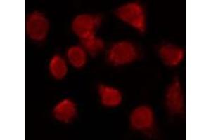 ABIN6266988 staining HuvEc by IF/ICC. (FOXE1 抗体  (N-Term))