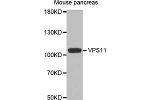 Western blot analysis of extracts of mouse pancreas, using VPS11 antibody. (VPS11 抗体)