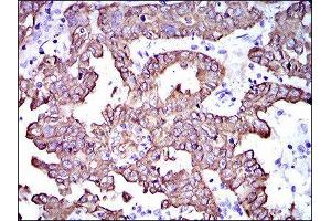 Immunohistochemistry (IHC) image for anti-Keratin 5 (KRT5) (AA 316-590) antibody (ABIN1845567) (Cytokeratin 5 抗体  (AA 316-590))