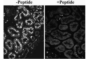 AP32082PU-N SLC26A6 Antibody overnight staining of paraffin embedded Human Kidney at 0. (SLC26A6 抗体  (Internal Region))